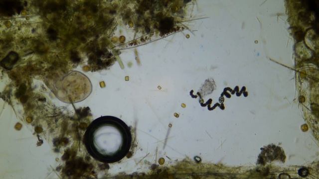 Stentor , трубач или стентор - род простейших из класса ресничных инфузорий смотреть онлайн