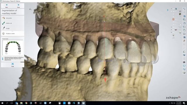 [Webinar] Making Clear Aligners Using The 3Shape Ortho System Module With Brandon Smith, CDT