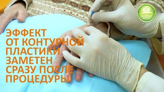 Контурная пластика - ответы на популярные вопросы смотреть онлайн