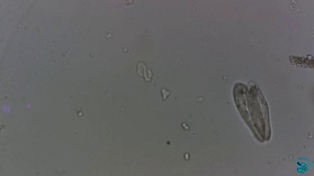 Конъюгация у инфузорий Paramecium. смотреть онлайн