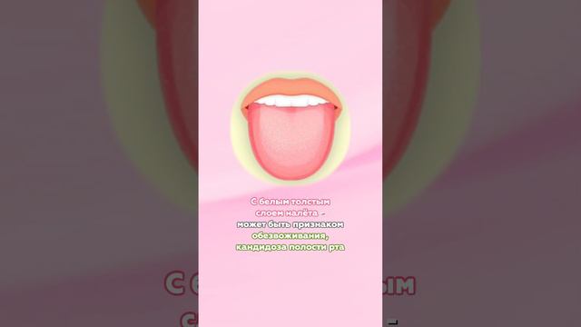 Язык предупредит вас о болезнях! | Как диагностировать состояние организма по языку? смотреть онлайн