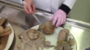 Анатомия: мочевыделительная система + половая система