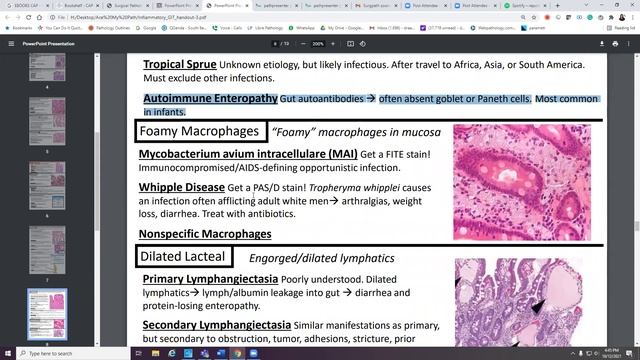 Day 1: GI Kurt's notes: Inflammatory patterns of GIT and IBD смотреть онлайн