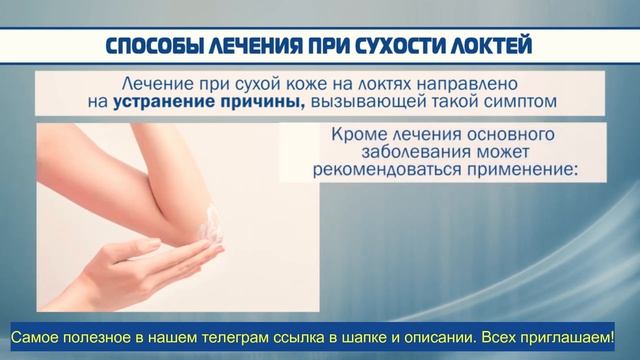 ??? Сухость кожи: причины, лечение смотреть онлайн