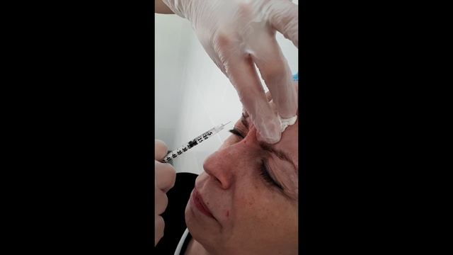 Ботулинотерапия. Основные моменты смотреть онлайн