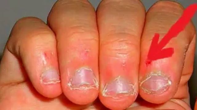 Люди, которые грызут НОГТИ — ОСОБЕННЫЕ! смотреть онлайн