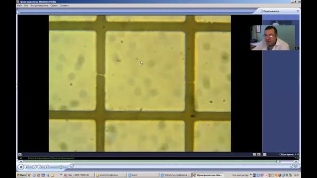 #Пылинки#в микроскопе смотреть онлайн