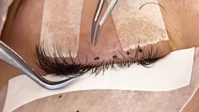 Наращивание ресниц. Процесс классического наращивания крупным планом. смотреть онлайн