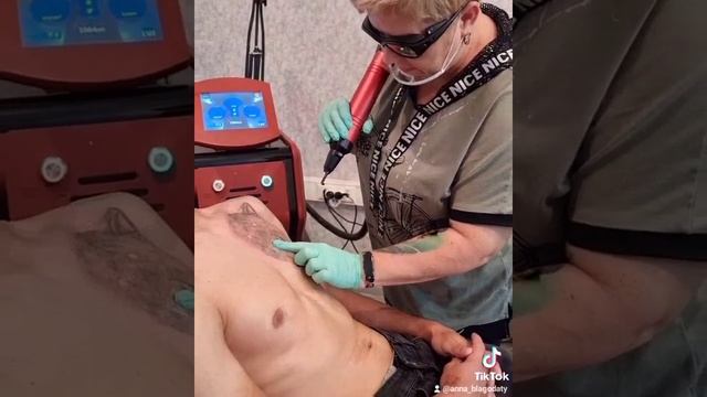 Профессиональное лазерное удаление татуировок Караганда смотреть онлайн