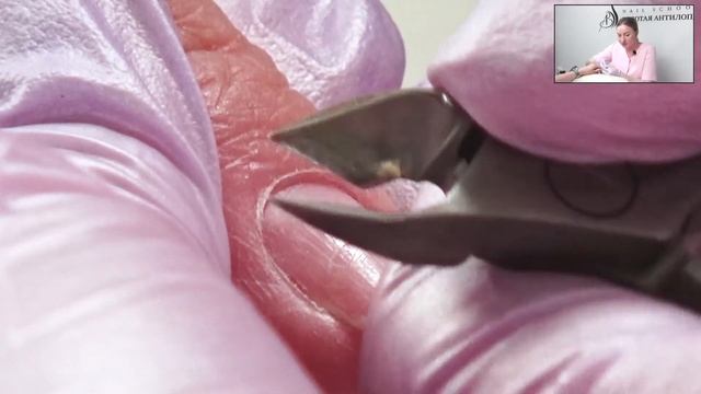 Не делай ошибки при маникюре, работая кусачками!!! | Обучение маникюру в школе "Золотая Антилопа" смотреть онлайн