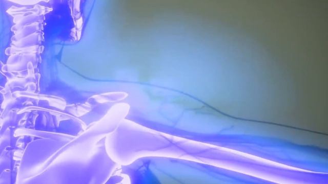 Чем полезен сушенный чернослив для организма смотреть онлайн