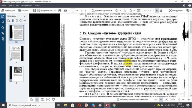 144 Синдром пустого турецкого седла смотреть онлайн