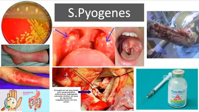 Bacterias gram positivas: estreptococo y enterococos. смотреть онлайн
