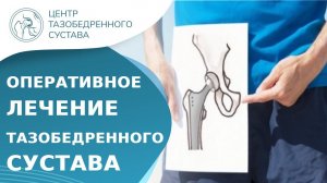 Операция тотального эндопротезирования тазобедренного сустава. Тотальное эндопротезирование. 18+