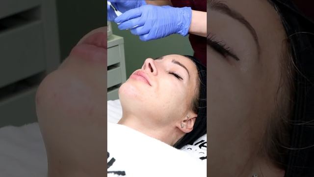 Retinolový peeling смотреть онлайн