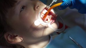 Короткая уздечка языка – коррекция или пластика уздечки языка |  стоматология Самара влог