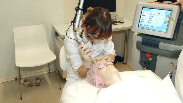 Как делают лазерный пилинг кожи