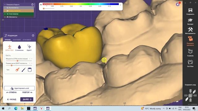 EXOCAD: БЕСПЛАТНЫЙ КУРС | УРОК 6: СОЗДАНИЕ КОРОНКИ НА ИМПЛАНТЕ (ЧАСТЬ 2) смотреть онлайн
