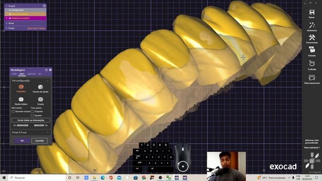 Planejamento Digital no Exocad com Jefferson Britez смотреть онлайн
