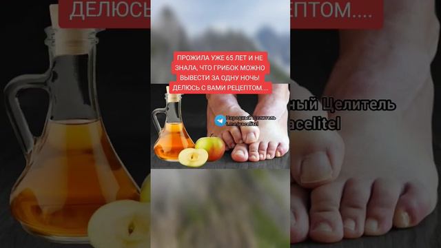 грибок можно вылечить за одну ночь #здоровье #рецепт #зож #народнаямедицина #безтаблеток #здоров смотреть онлайн