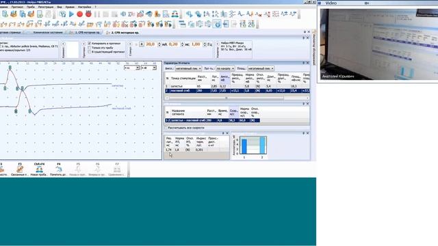 Вебинар о типичных ошибках при стимуляционной ЭМГ