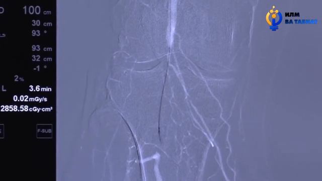 Теги Сино - Диабети қанд қисми 2 смотреть онлайн