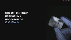 Классификация кариозных полостей по Блэку | Кариесология