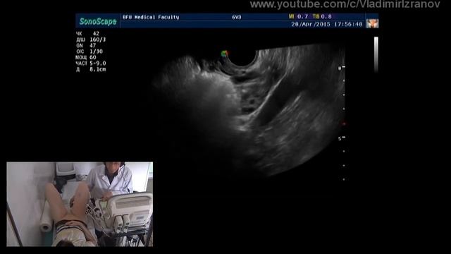 Практическое занятие: УЗИ органов малого таза. Пациентка 4 смотреть онлайн