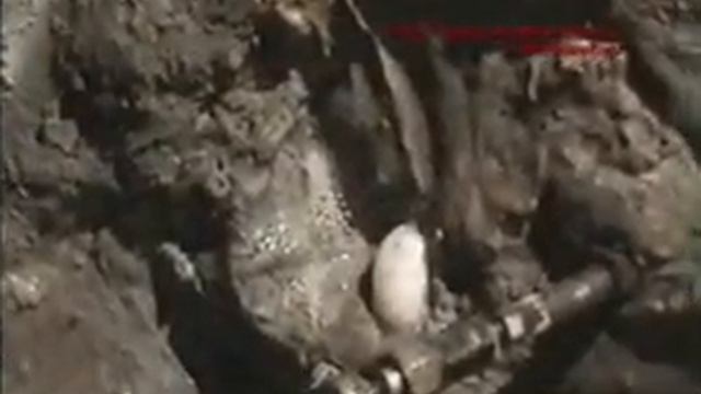 Остановка активных течей, инъекцииУСЭР смотреть онлайн