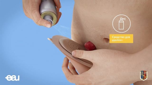 Разъяснения по смене мешка стомы (EAU - SBR RU) смотреть онлайн