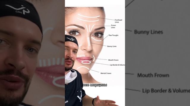 Морщины на лице #shorts смотреть онлайн