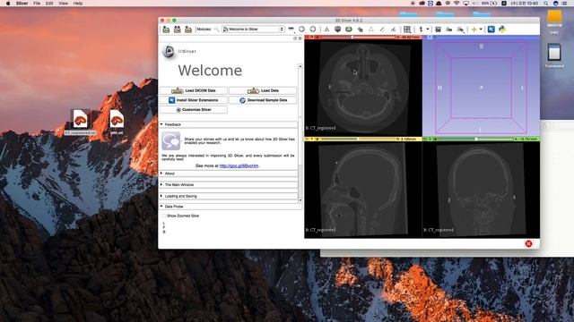 Tutorial of 3D Slicer (install and simple modeling) смотреть онлайн