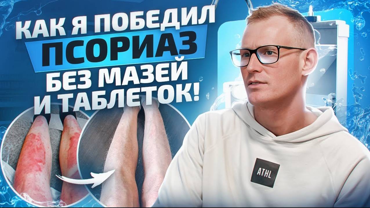Вылечил псориаз без мазей и таблеток с помощью воды ПВВК. История клиента смотреть онлайн