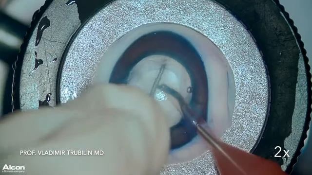 Prof. Vladimir Trubilin MD, Case 2 смотреть онлайн