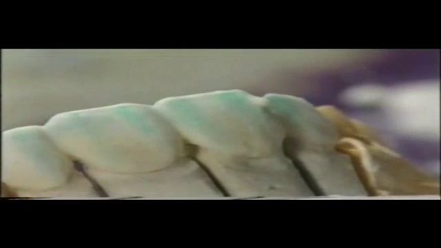 Создание керамических виниров. Пауль Фихтер. смотреть онлайн