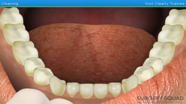 Top Way To Play Surgery Squad Teeth Cleaning Simulator смотреть онлайн