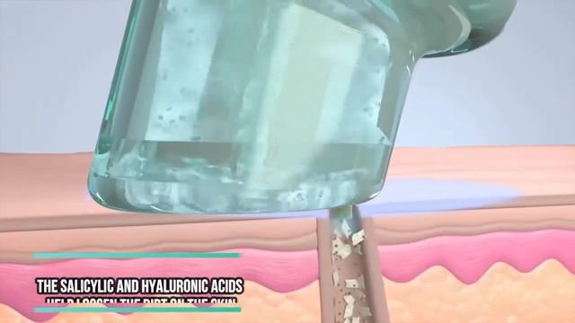 All About HydraFacial Elite! смотреть онлайн