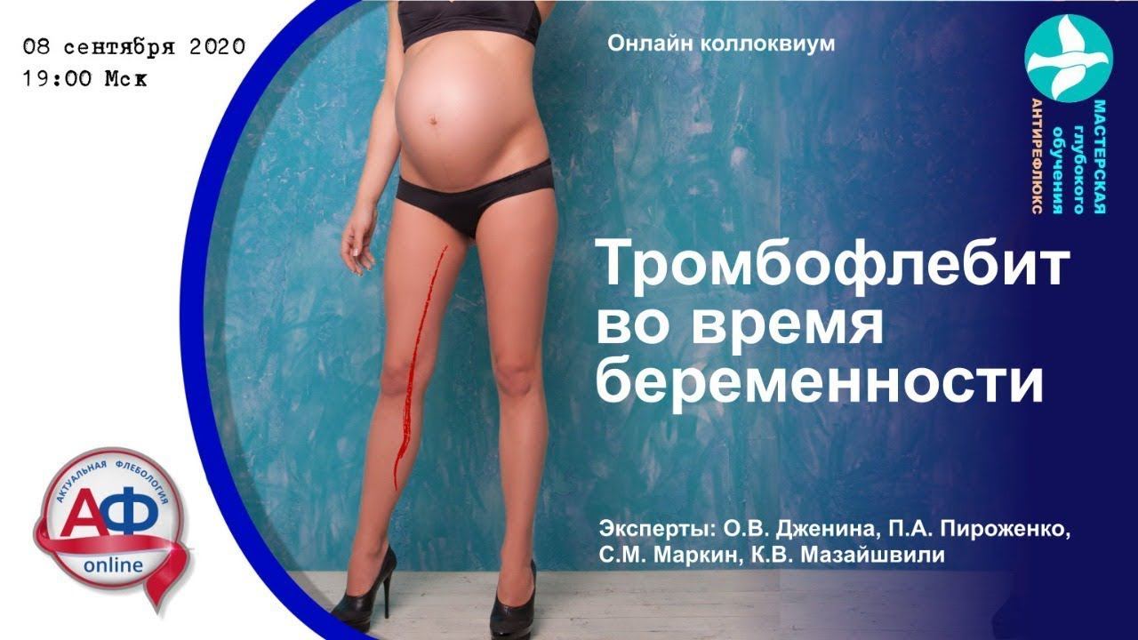 Тромбофлебит во время беременности смотреть онлайн