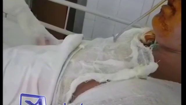 Облитая кипятком