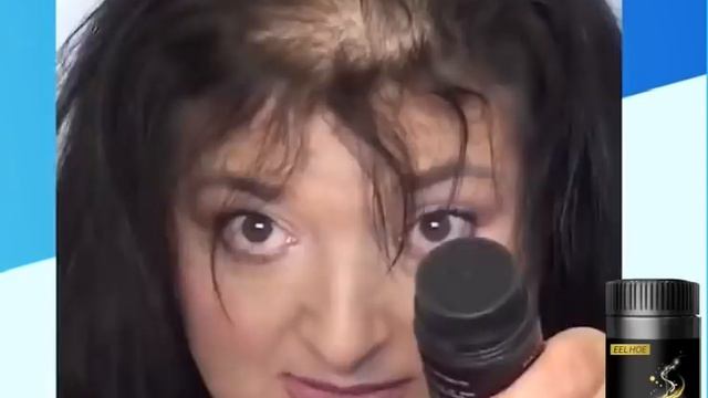 Ginger Essence Nourishing Hair Growth Powder【Buy 1 Get 3】