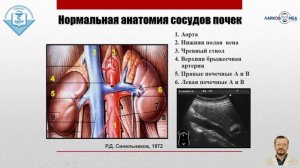 УЗИ аорты и нижней полой вены, Часть 2 / Лайков Алексей Владимирович - врач УЗИ, к.м.н.