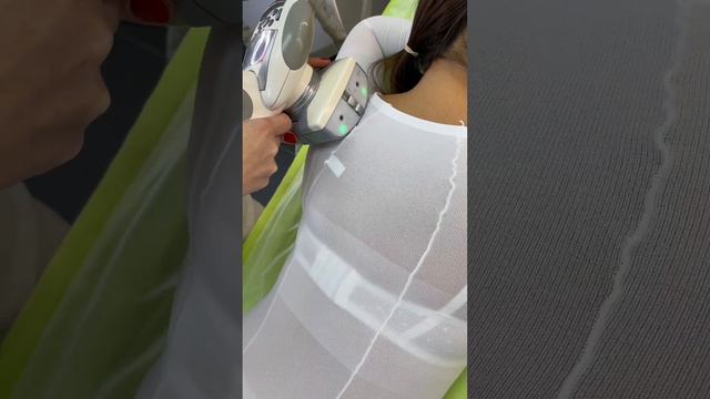 LPG массаж смотреть онлайн