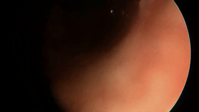 Инородный предмет в трахее у собаки смотреть онлайн