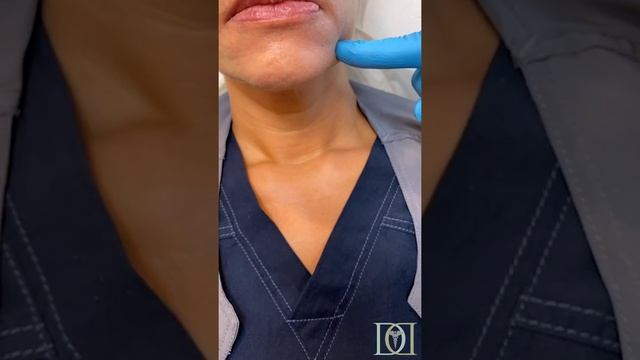 BOTOX 201: Chin + DAO смотреть онлайн