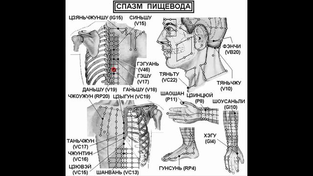 Как вылечить спазм пищевода. Эзофагит смотреть онлайн