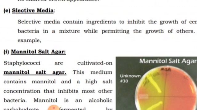 Types of culture media, Microbiology lecture by: Dr. Abdul Manaf Alvi смотреть онлайн