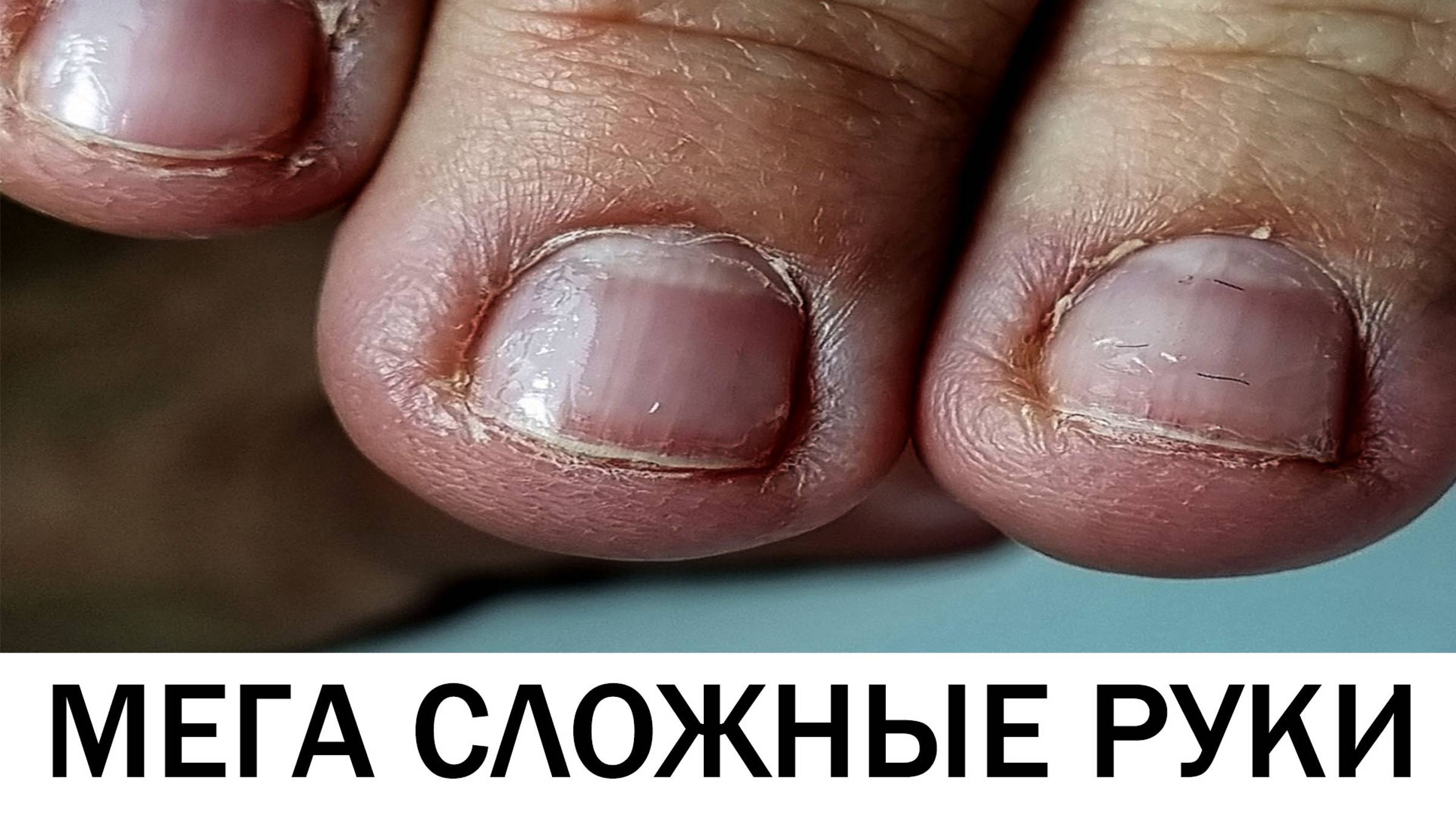 УЖАС!!!    сложные руки