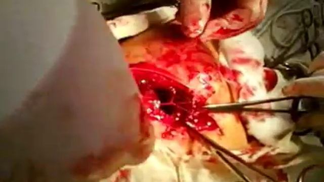 История хирургического отделения Малинского МРТМО смотреть онлайн