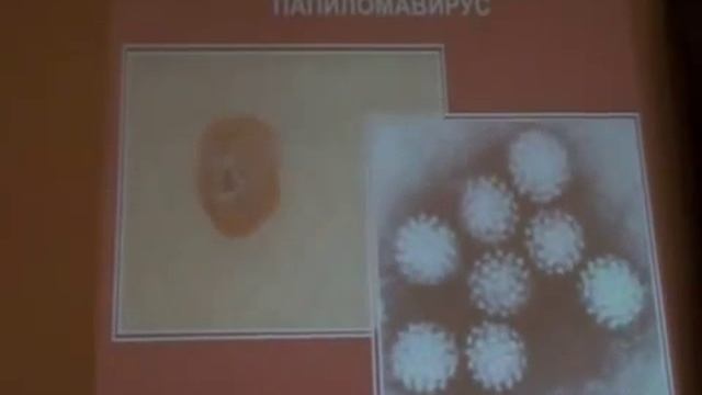 Вирусы в организме человека. Бутакова О.А.