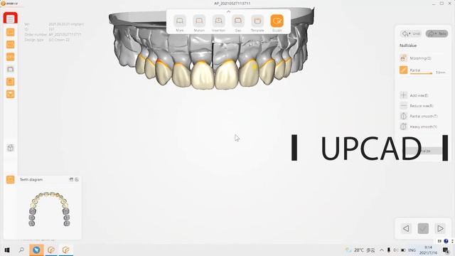 How to use our new products to make a long bridge restoration? смотреть онлайн